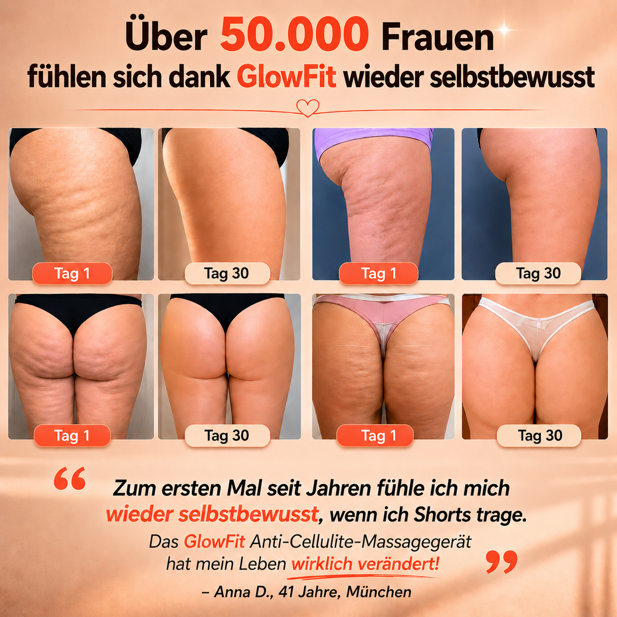 Über 50.000 Frauen haben sich für ELA entschieden · 14 Tage Garantie